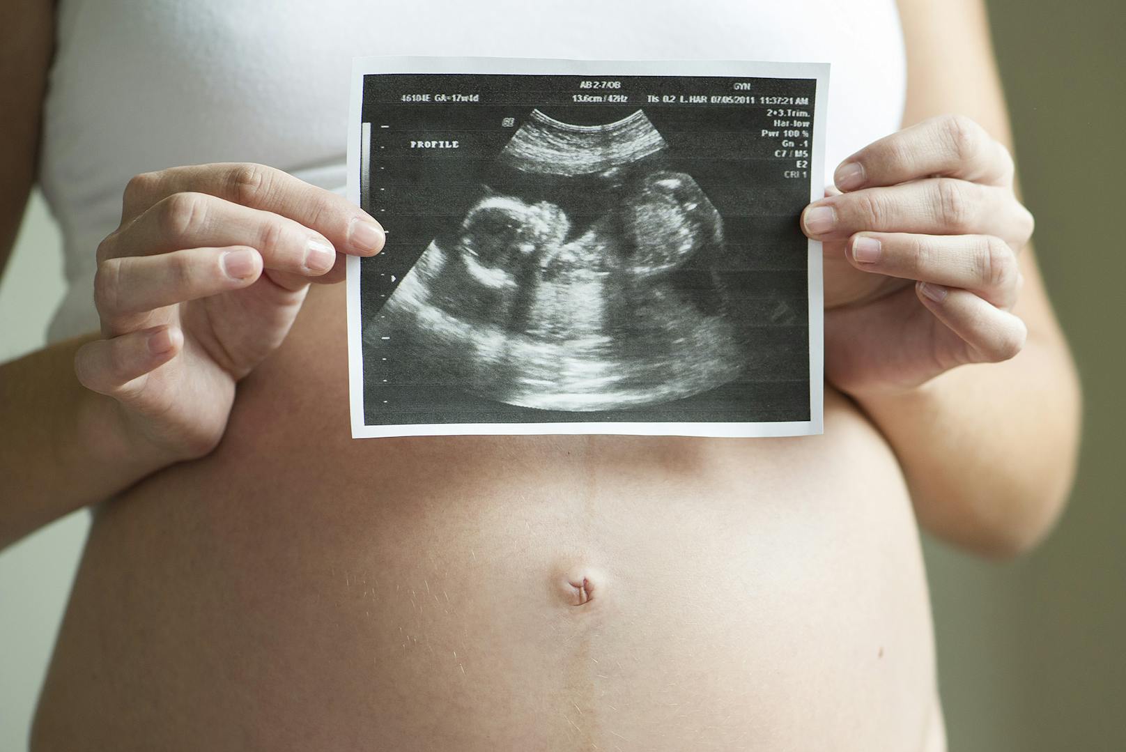 Das liegt an der vorgeburtlichen Entwicklung: Im frühen Stadium sind Embryonen Zwitter. Während sich Eierstöcke und Hoden erst später bilden, sind die Brustwarzen schon bei weiblichen wie männlichen Embryonen gleich.