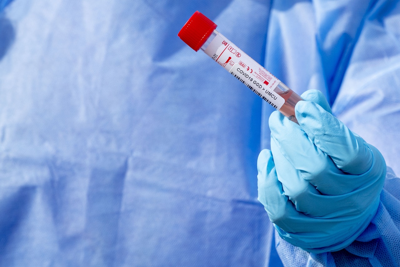 Heute.at - Frau infizierte sich zum 2. Mal in kurzer Zeit