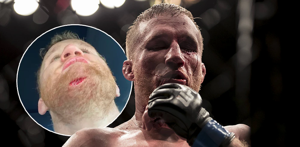 Justin Gaethje kassierte im Training.