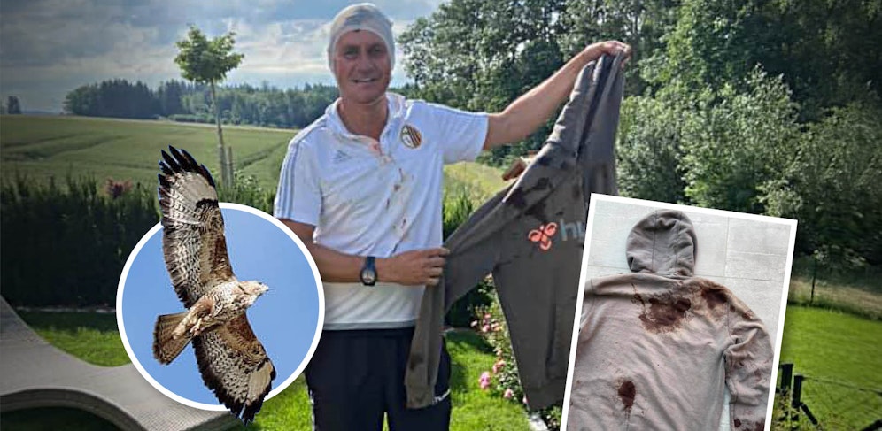 Der Jogger Gerald Eiblmayr wurde von einem Mäuse-Bussard attackiert und verletzt.