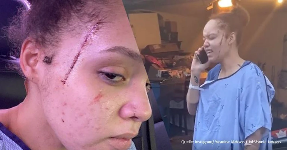 Yasmine Jackson wurde bei einer Messer-Attacke verletzt.