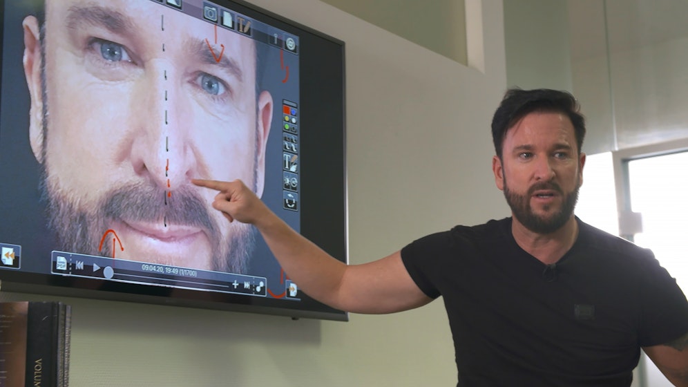 Schlagersänger <strong>Michael Wendler</strong> möchte sich bleibend von seiner alten Nase verabschieden.