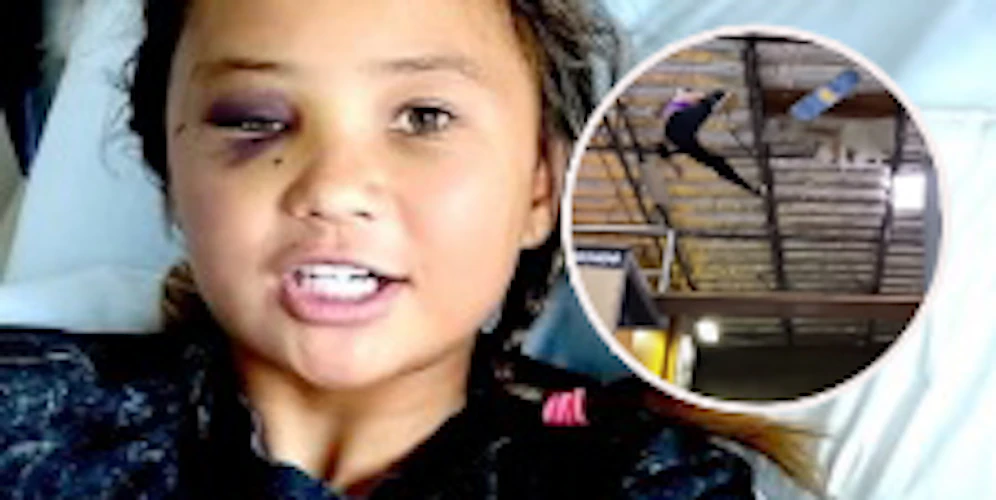 Sky Brown schockiert ihre Fans mit dem Video ihres schlimmsten Sturzes.