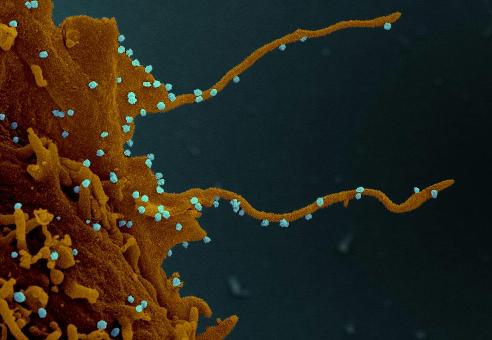 Der Virus Sars-CoV-2 auf einer infizierten Zelle mit langen Filopodien.