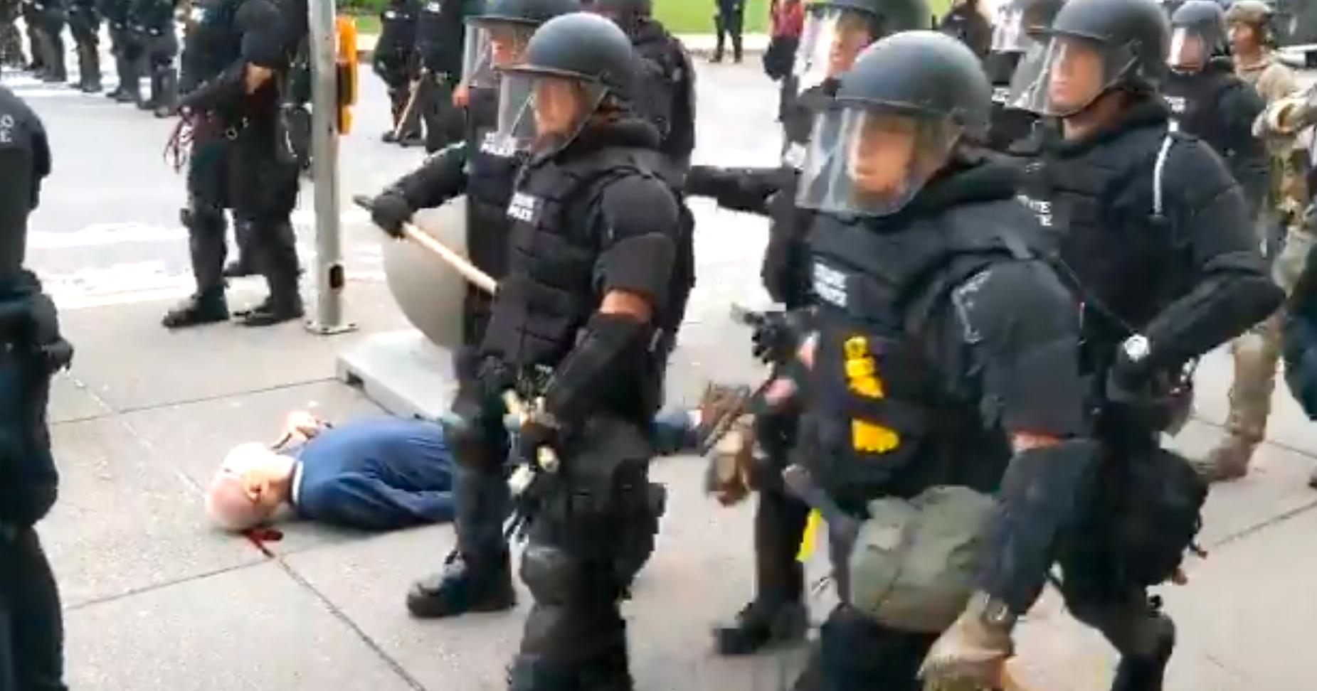 Die Beamten stießen den 75-Jährigen um, dieser schlug mit dem Hinterkopf auf dem Asphalt auf.