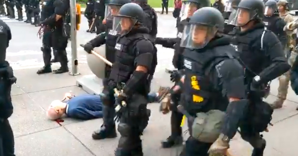 Die Beamten stießen den 75-Jährigen um, dieser schlug mit dem Hinterkopf auf dem Asphalt auf.