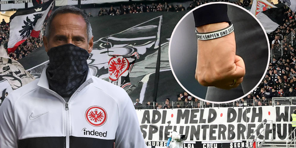 Frankfurt-Trainer Adi Hütter trägt ein Armband der Ultras.