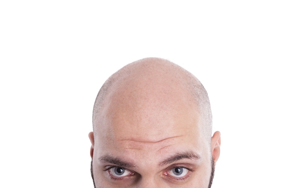 Ein Gericht in Großbritannien entschied, dass Aussagen über die Glatze eines Mannes sexuelle Belästigungen seien.