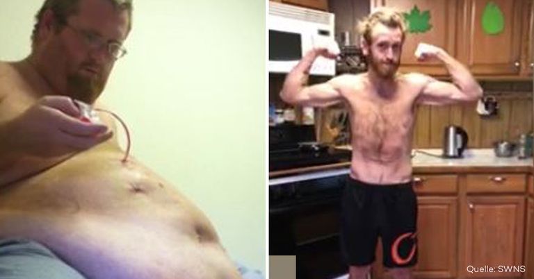 Der Mann nahm unglaubliche 158 Kilogramm ab.