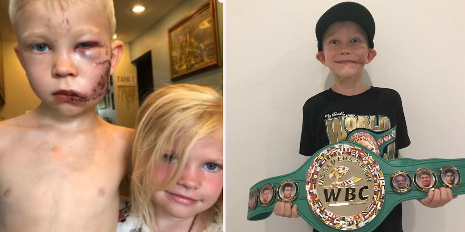 Bridger Walker rettete seine kleine Schwester, jetzt ist er WBC-Ehrenchampion.