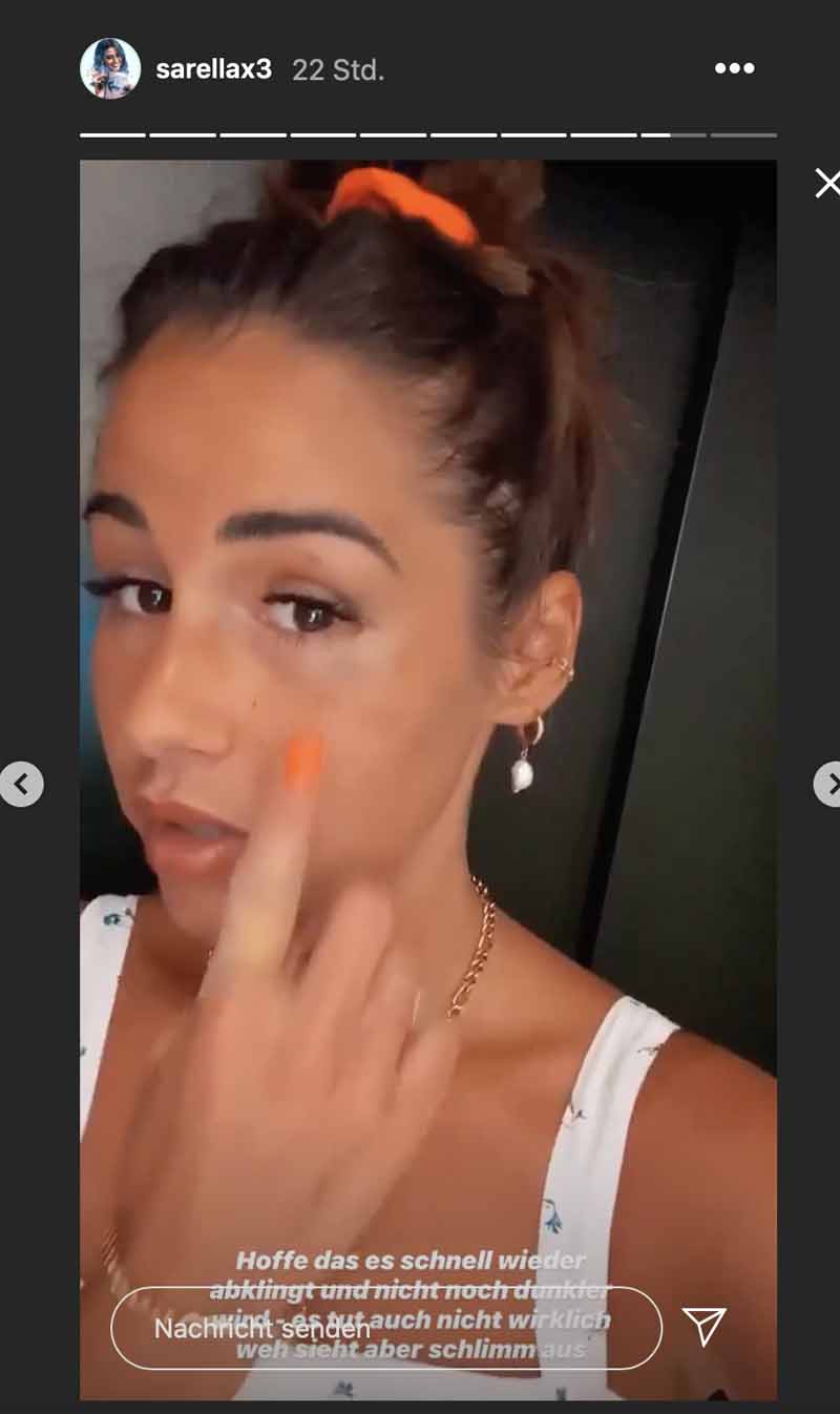 Sarah Lombardi und ihr Veilchen