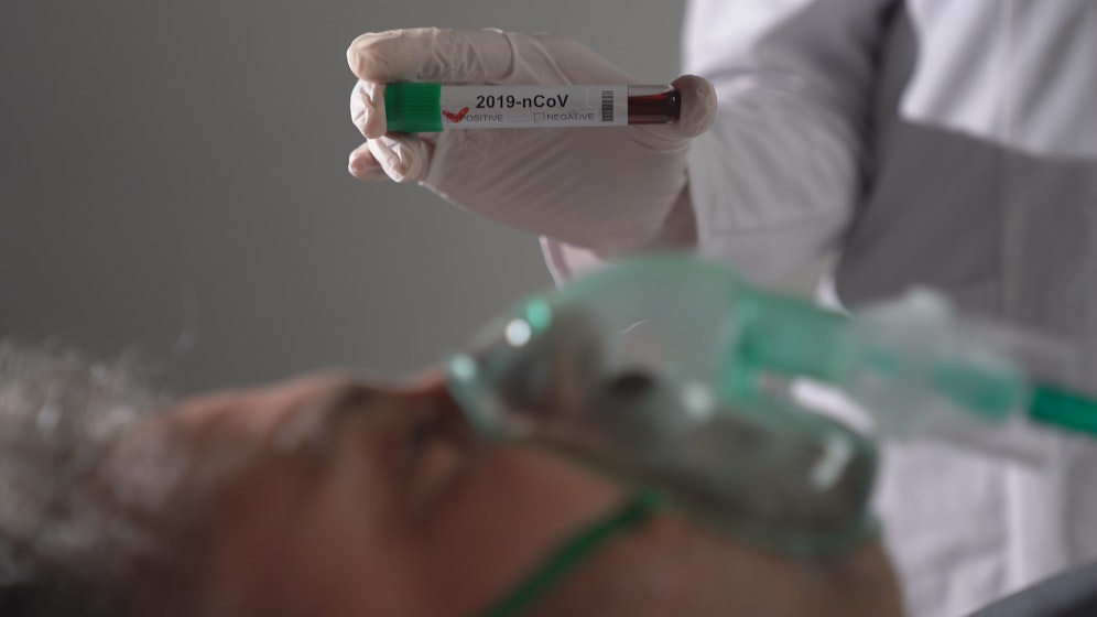 Jeder zweite Coronavirus-Patient, der auf einer Intensivstation behandelt wurde und beatmet werden musste, verstarb.