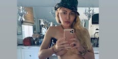 Madonna zeigt sich nackt mit Krücke
