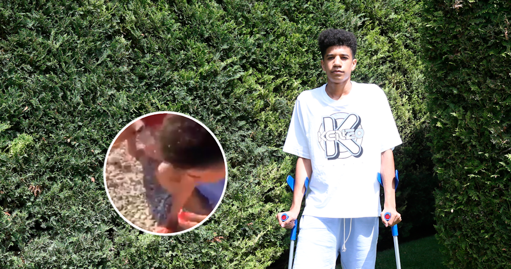 Elias wurde grundlos die Nase gebrochen.