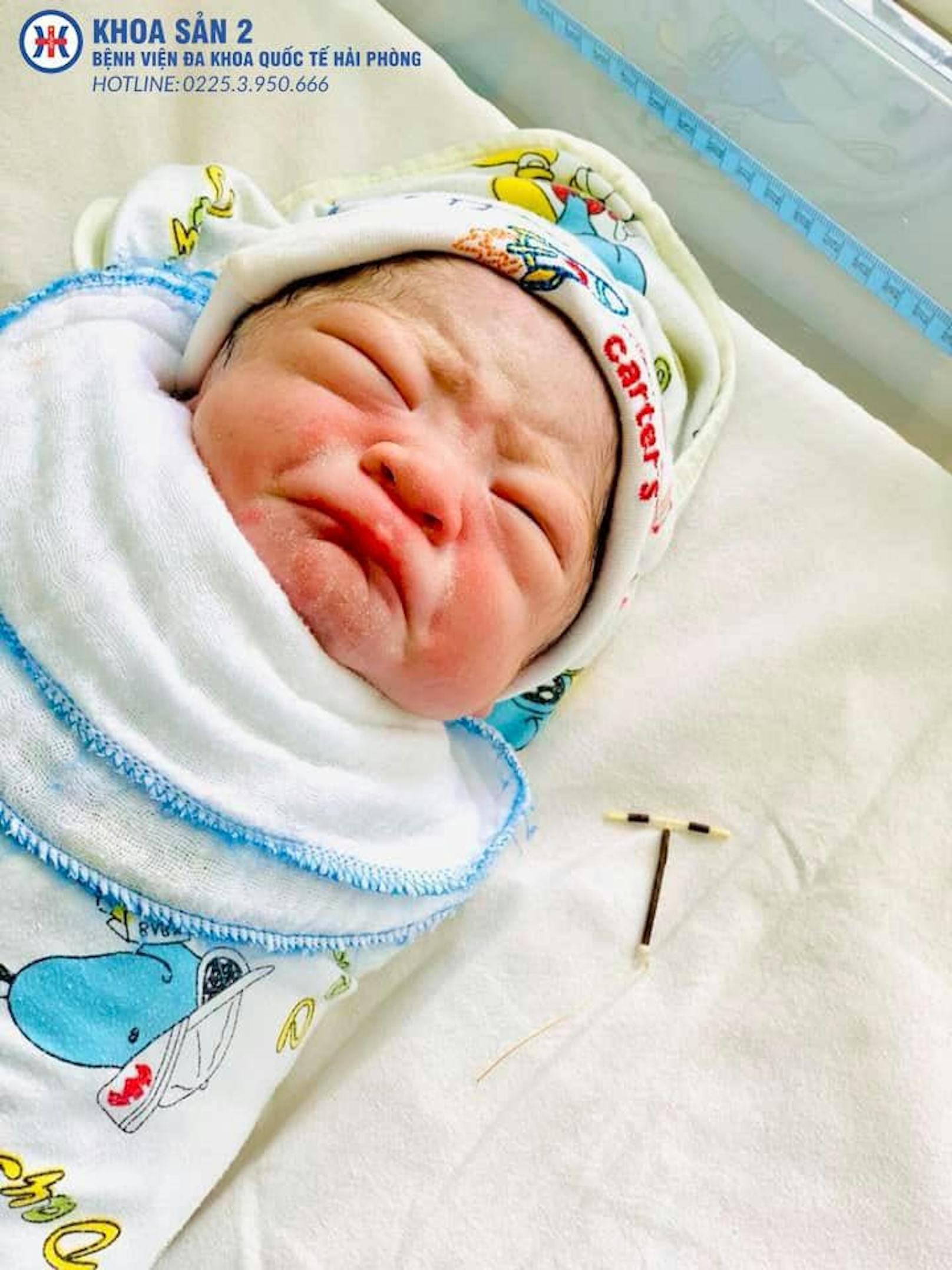 Gegen alle Widrigkeiten: In Vietnam kam am 30. Juni 2020 ein Baby mit einer "Spirale" in der Hand zur Welt. Eigentlich hätte das Verhütungsmittel eine Schwangerschaft verhindern sollen.