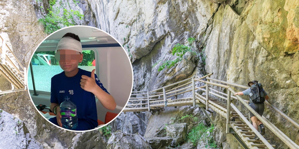 Bub (10) wurde von Felsstück am Kopf getroffen.