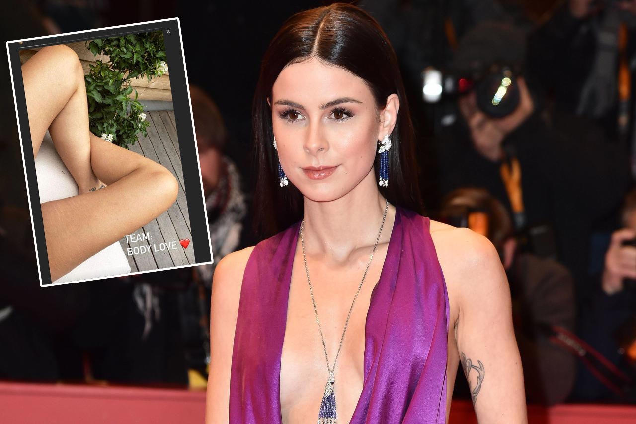 Heute.at - Lena Meyer-Landrut zeigt ihre Dehnungsstreifen