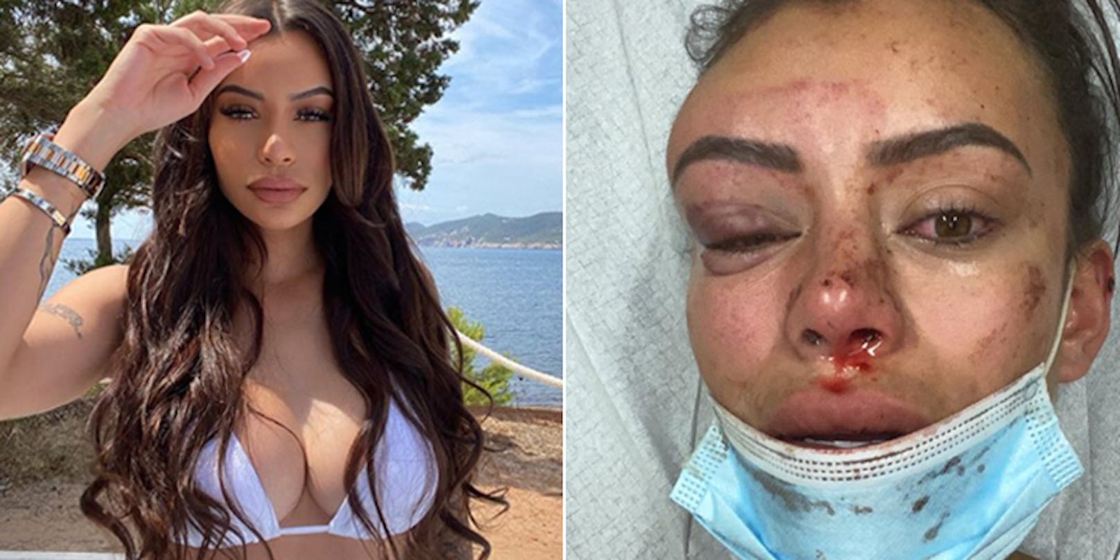 Yasmine Cécilia wurde geschlagen und getreten.