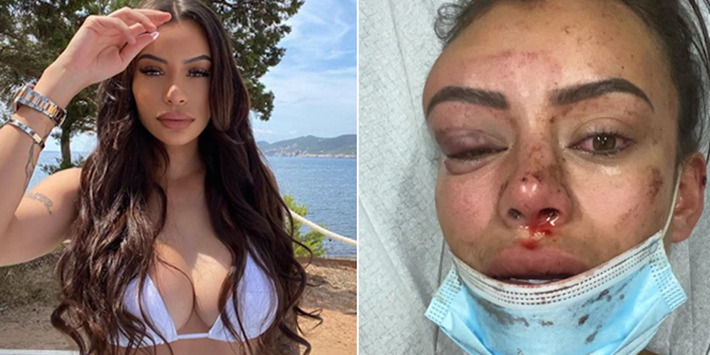 Yasmine Cécilia wurde geschlagen und getreten.