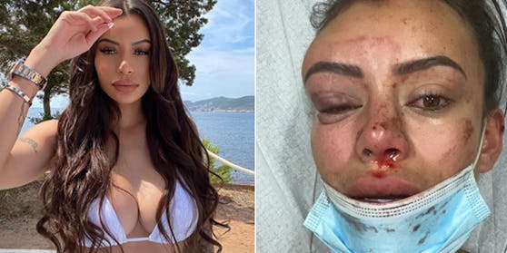 Yasmine Cécilia wurde geschlagen und getreten.