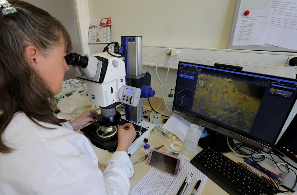 Erstmals haben Forscher Mikroplastik in den menschlichen Organen nachgewiesen. Es gelangt durch die Luft, die wir atmen, unsere Nahrung und das Wasser, das wir trinken, in die Körper. 