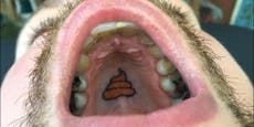 Belgier sticht Tattoos, die nur der Zahnarzt sieht