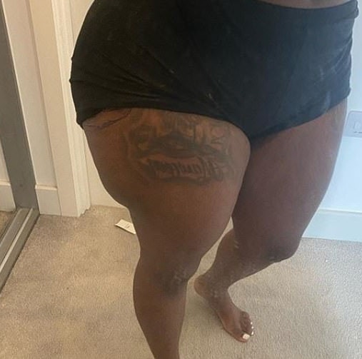 Die junge Frau warnt nun vor solchen Eingriffen.