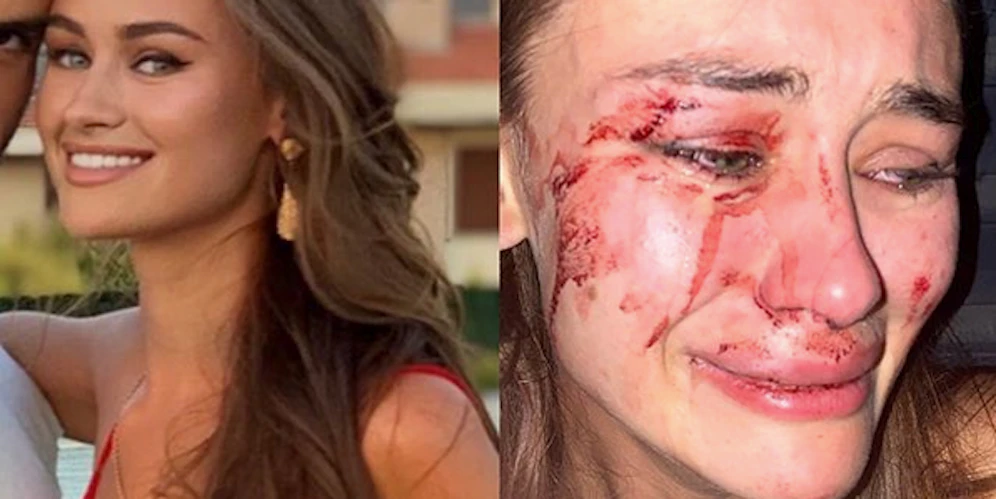 Das Model Daria Kyryliuk vor und nach der Tat