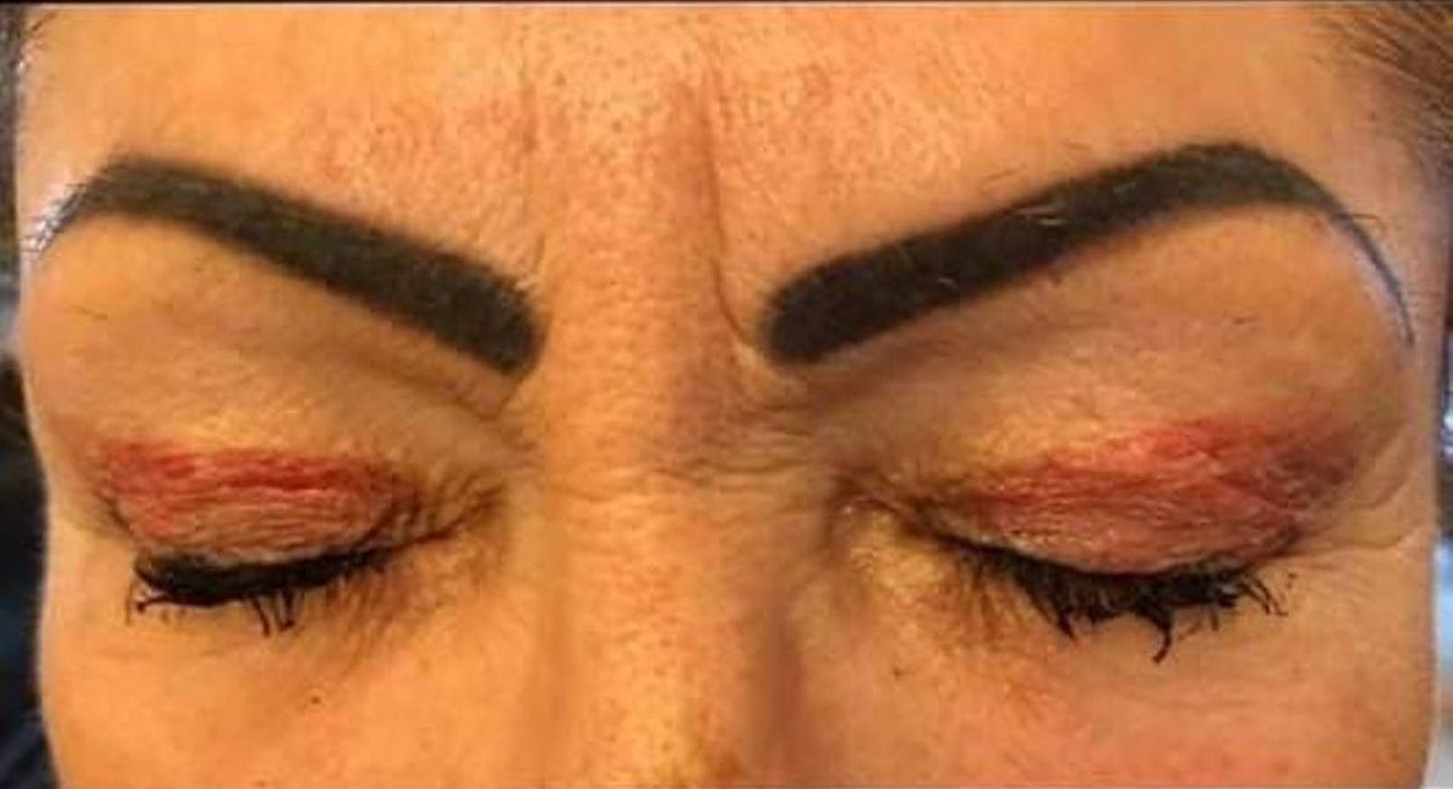 Pfusch nach Augenlidschattierung: Eine Frau aus dem Kanton Waadt erlebte nach einer kosmetischen Behandlung eine böse Überraschung.