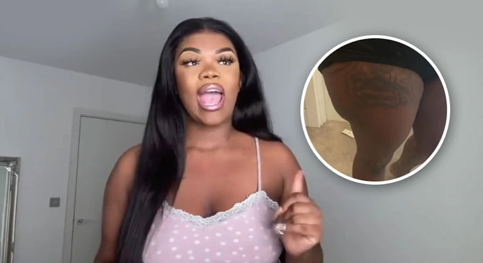 Die britische YouTuberin Renèe Donaldson hat nach einem Po-Lifting höllische Schmerzen.