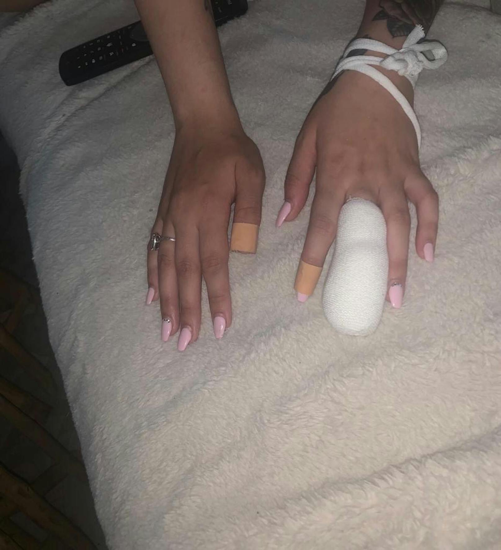 Die verletzte Frau mit dem verbundenen Finger