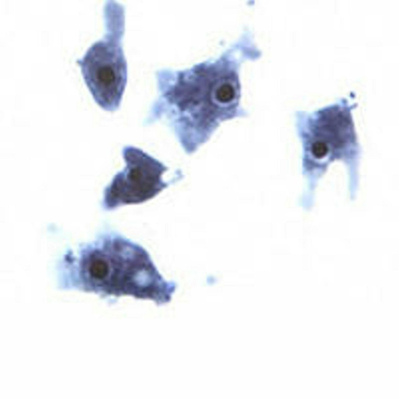 Heute.at - Bub stirbt nach Bad im See an hirnfressender Amöbe