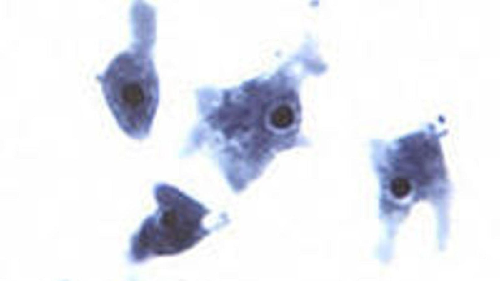 Schuld an seinem Tod: Naegleria fowleri, einer der tödlichsten Parasiten der Welt. (Im Bild: Naegleria fowleri)