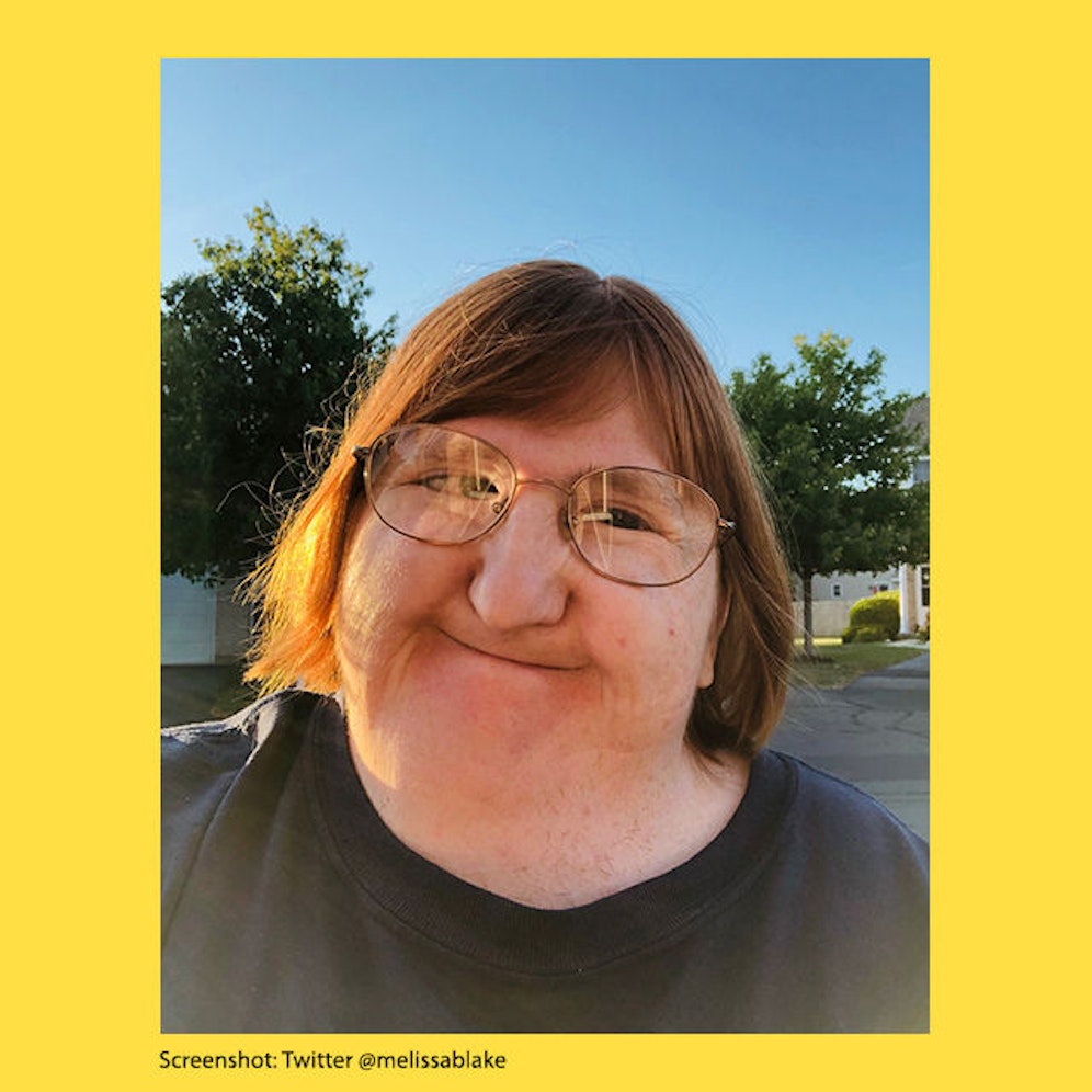 Die Journalistin Melissa Blake erfuhr von Freunden, dass ihr Gesicht für die 