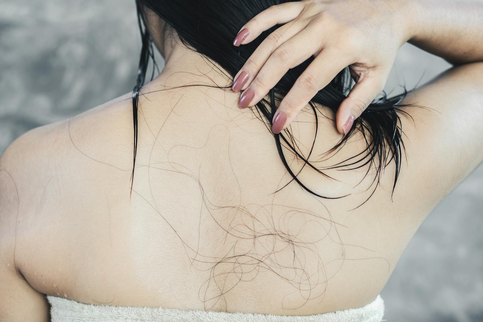 Haarausfall wird durch zu häufiges Haare waschen zwar nicht herbeigeführt, aber begünstigt.