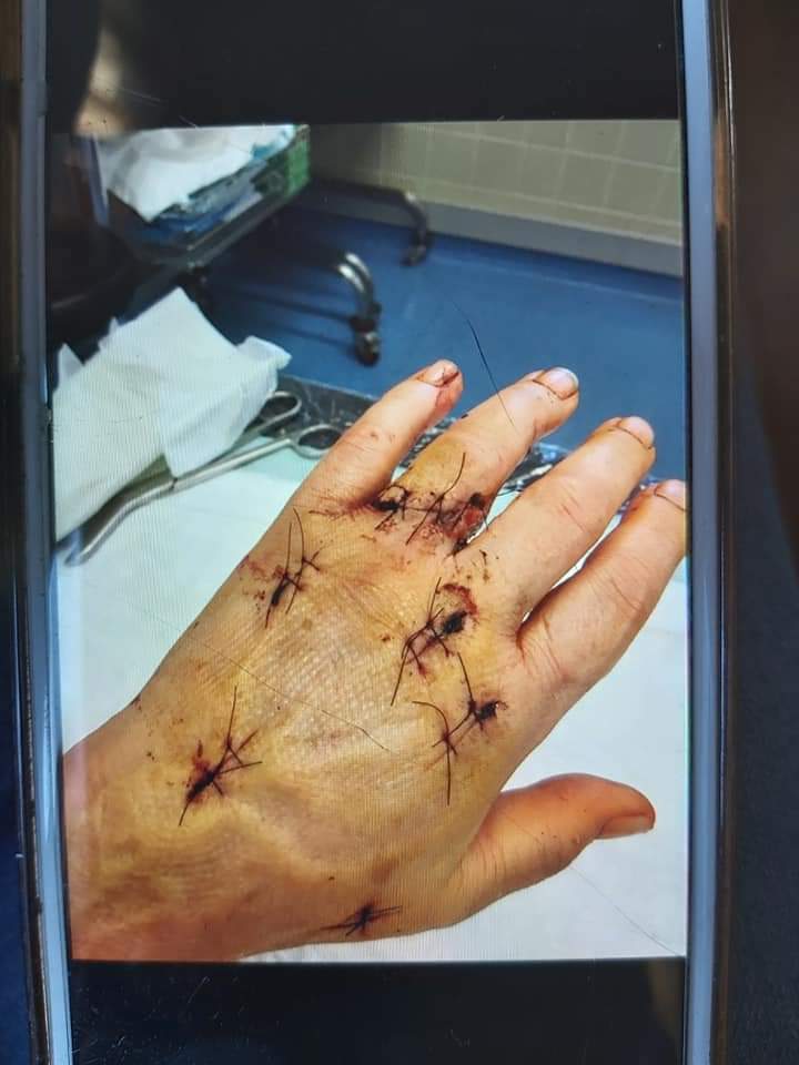 Mehrere Operationen hat die Frau schon hinter sich.