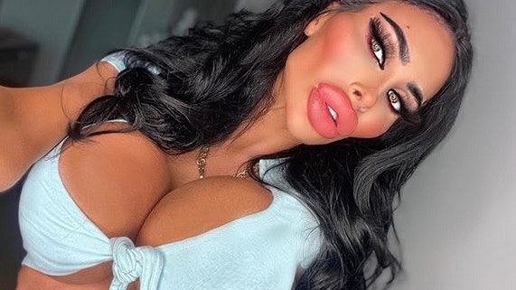 Süchtig nach Schönheits-OPs