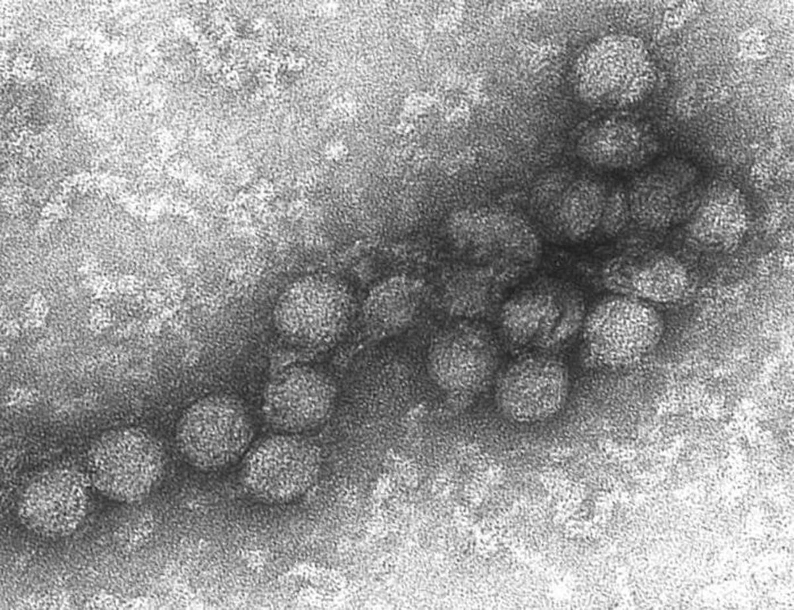 Was auf den ersten Blick recht unscheinbar aussieht, macht Medizinern Sorgen: das West-Nil-Virus.