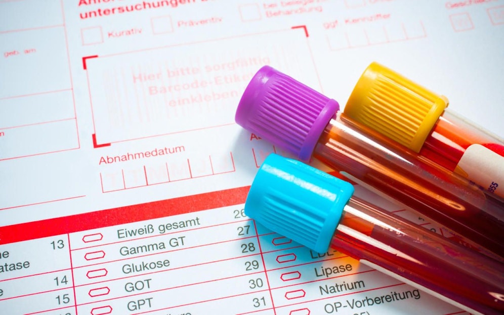 Zu hohe Blutfettwerte führen zu einem Herzinfarkt.