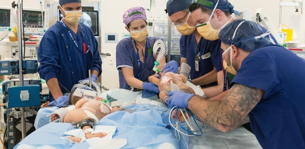 Die Babys nach der erfolgreichen Operation