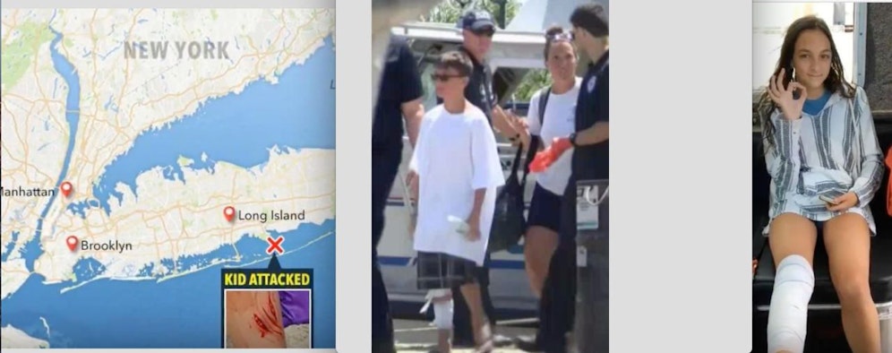 Noch mal davon gekommen: Ein Hai griff einen Buben (13, li.) und Lola P. (12) vor New York an. Sie erlitten Bisswunden am Bein. 