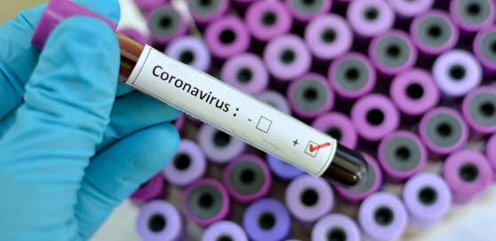 Rund vier von zehn Infizierten steckten sich trotz beider Impfungen mit dem Coronavirus an.&nbsp;