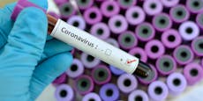 Vier von zehn Corona-Infizierten sind durchgeimpft