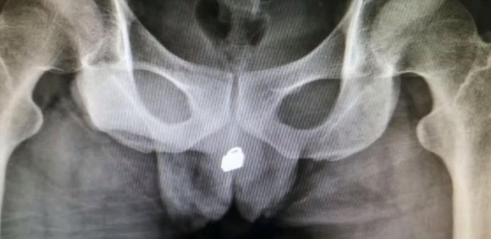 Hier das unglaubliche Röntgenbild.