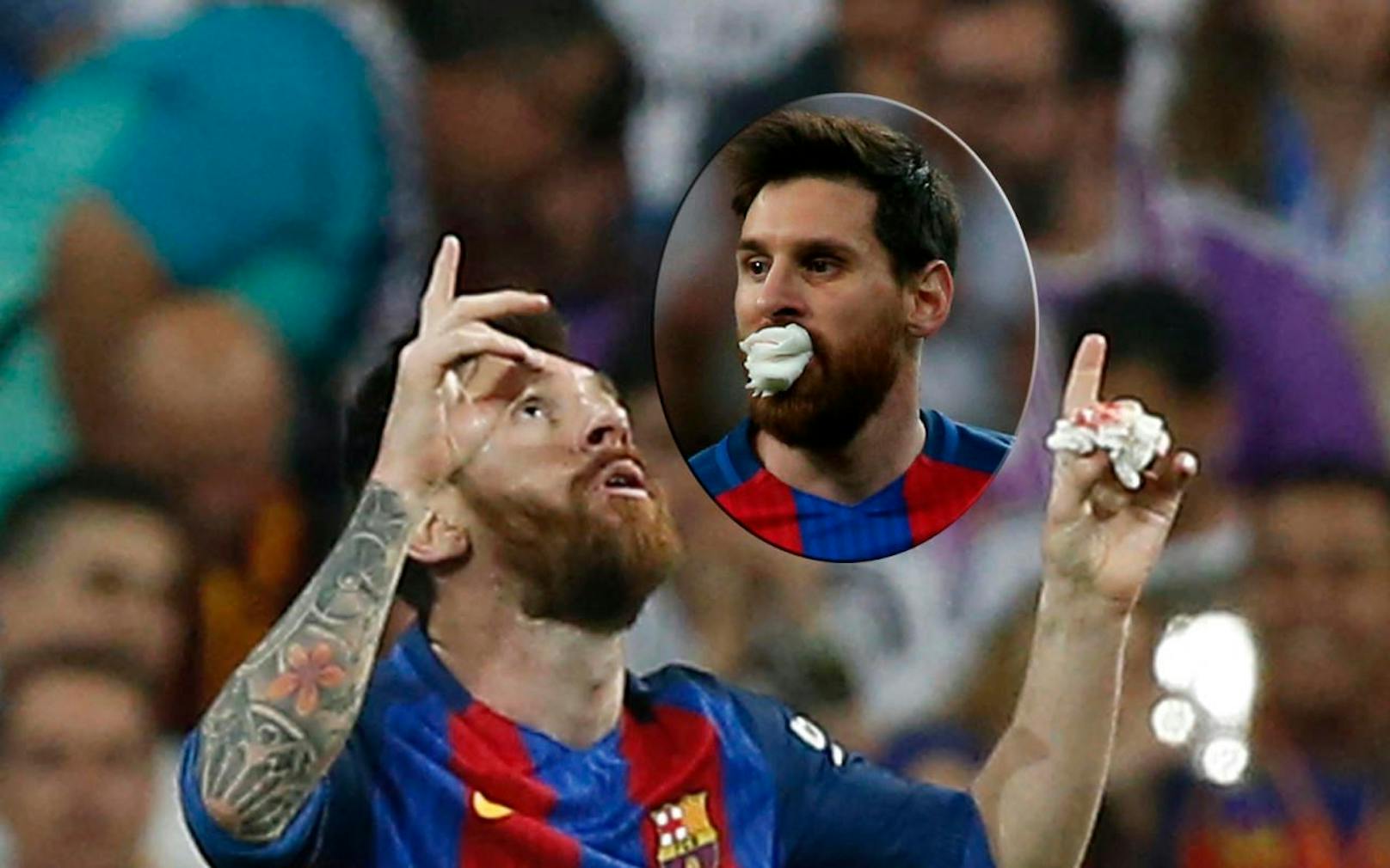 Superstar Messi spuckte nach einem Check Blut, spielte daher mit Taschentuch weiter.
