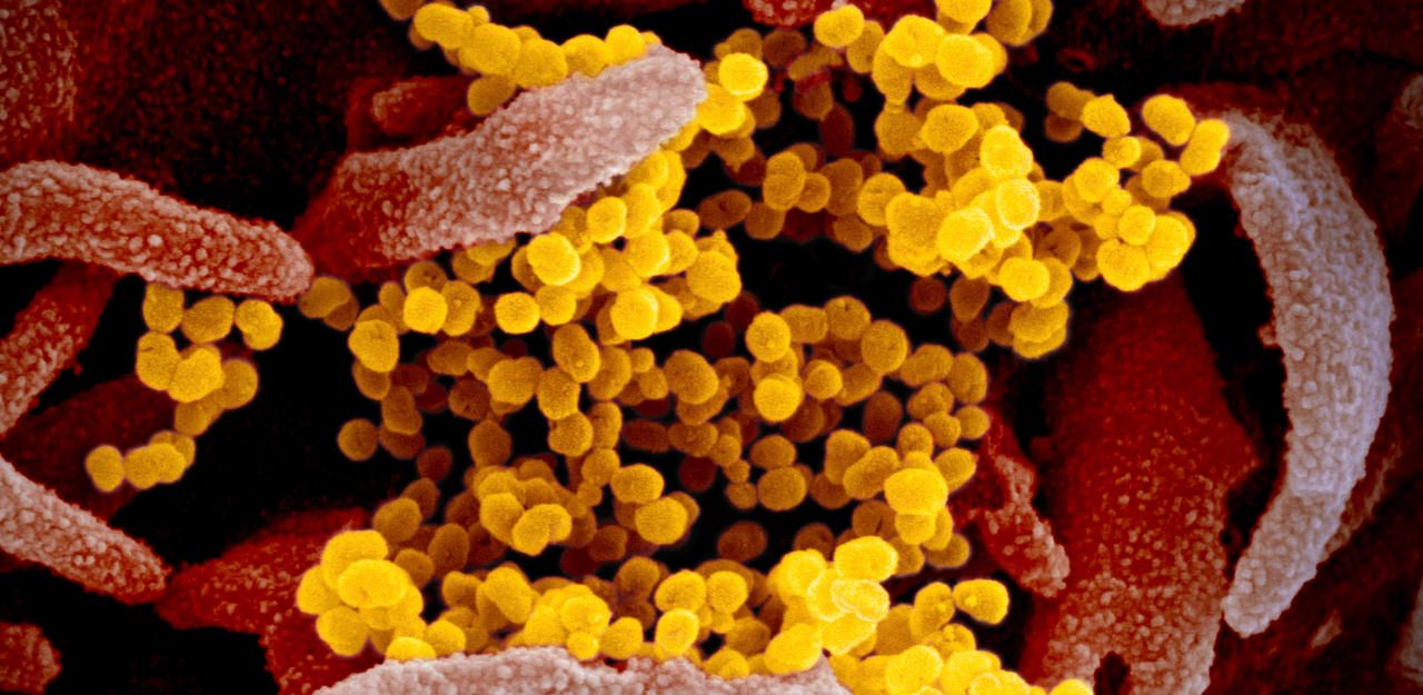 Heute.at - Coronavirus oder Grippe – was ist der Unterschied?