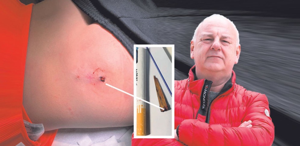 Werner B. (55) ärgert sich über Nicht-Behandlung seines Sohnes im KH Nord.