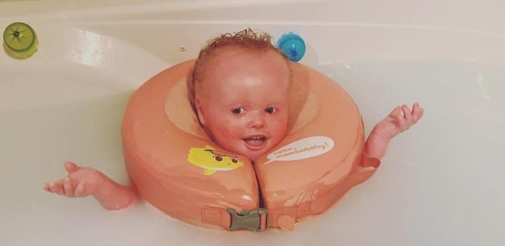 Baby muss alle 2 Stunden baden, um zu überleben