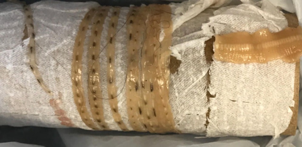 Bandwürmer können bis zu 1,5 Meter lang werden (Symbolbild/Kenny Bahn/This Won't Hurt A Bit