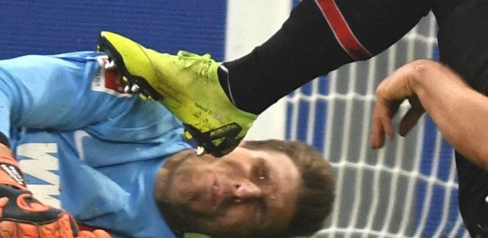 Augsburg-Torhüter Andreas Luthe biss sich bei einem Zusammenprall ein Stück seiner Zunge ab. 